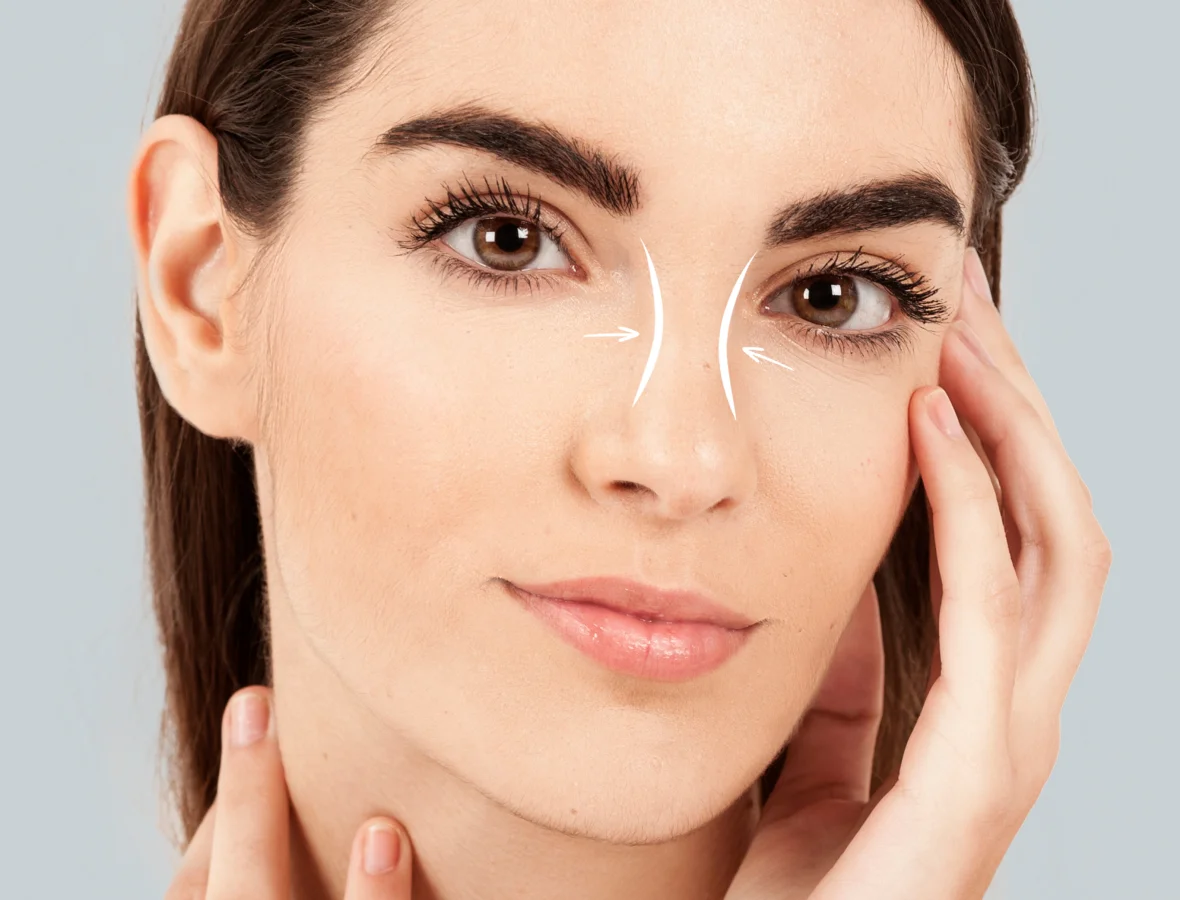 home 1 8 rhinoplasty